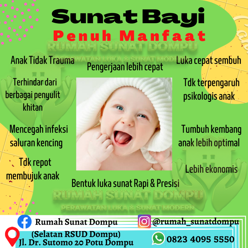 sunat bayi dompu