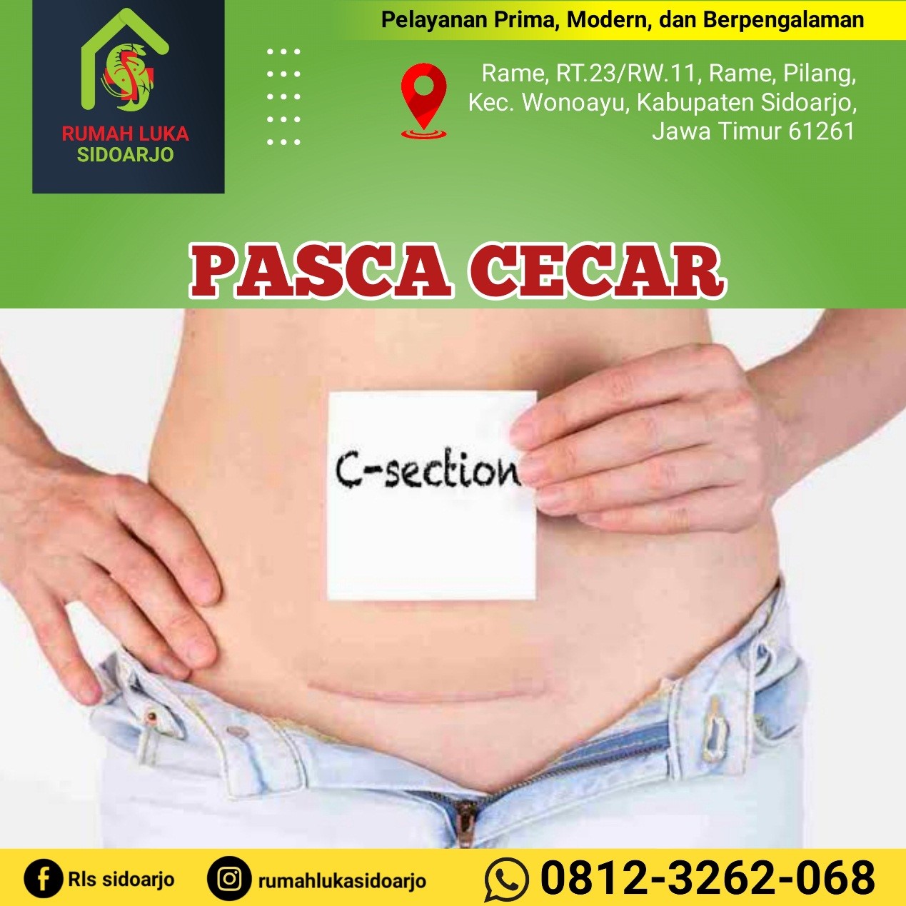 08123262068 Rumah Luka Gedangan Sidoarjo, Pusat Perawatan Luka Pasca Operasi Caesar .