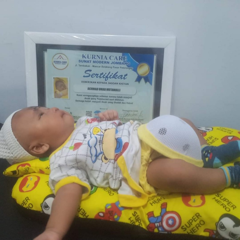 BIUS KHITAN TANPA SUNTIK DI JOMBANG, METODE MODERN YANG AMAN