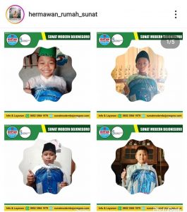 Bius Khitan Tanpa Suntik di Bojonegoro