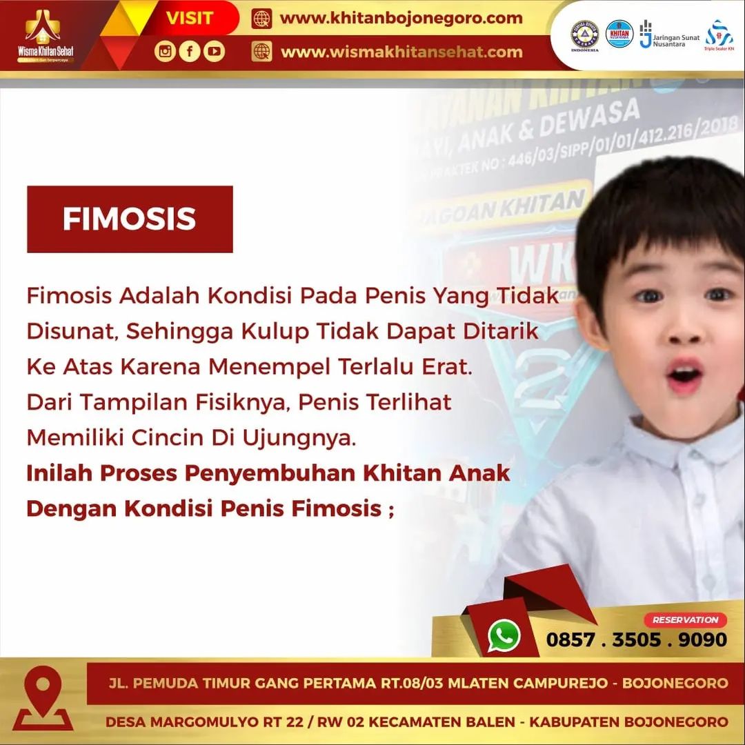 Sunat Anak dengan Penyulit Fimosis di Wisma Khitan Sehat Bojonegoro
