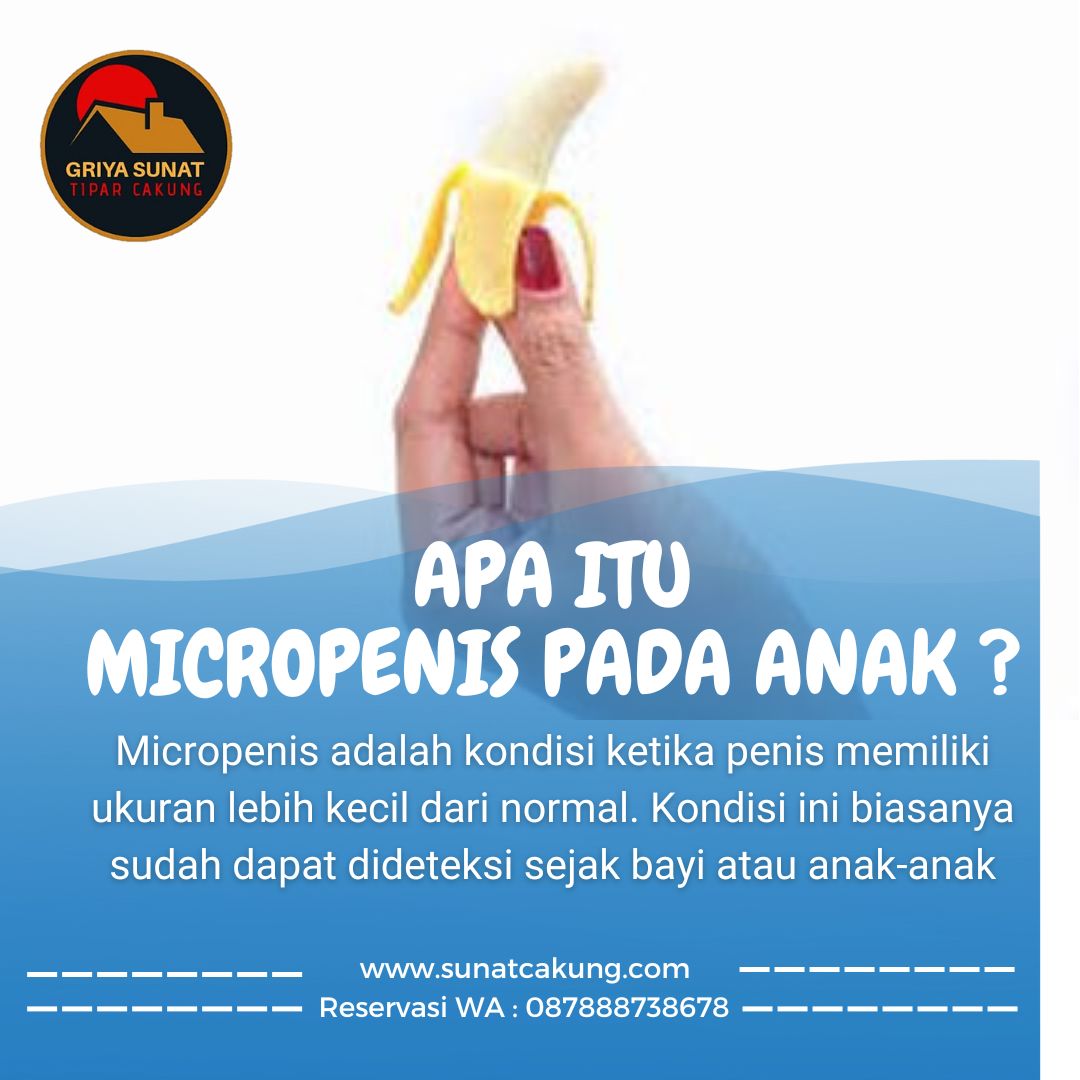 Micropenis: Salah Satu Penyulit pada Khitan Anak