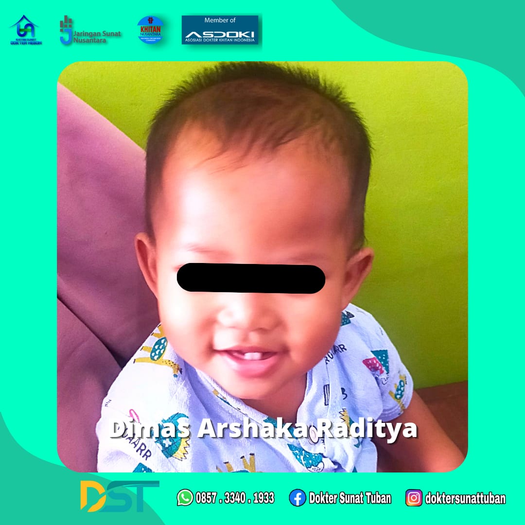 Pilihan Terbaik untuk Sunat Bayi di Tuban