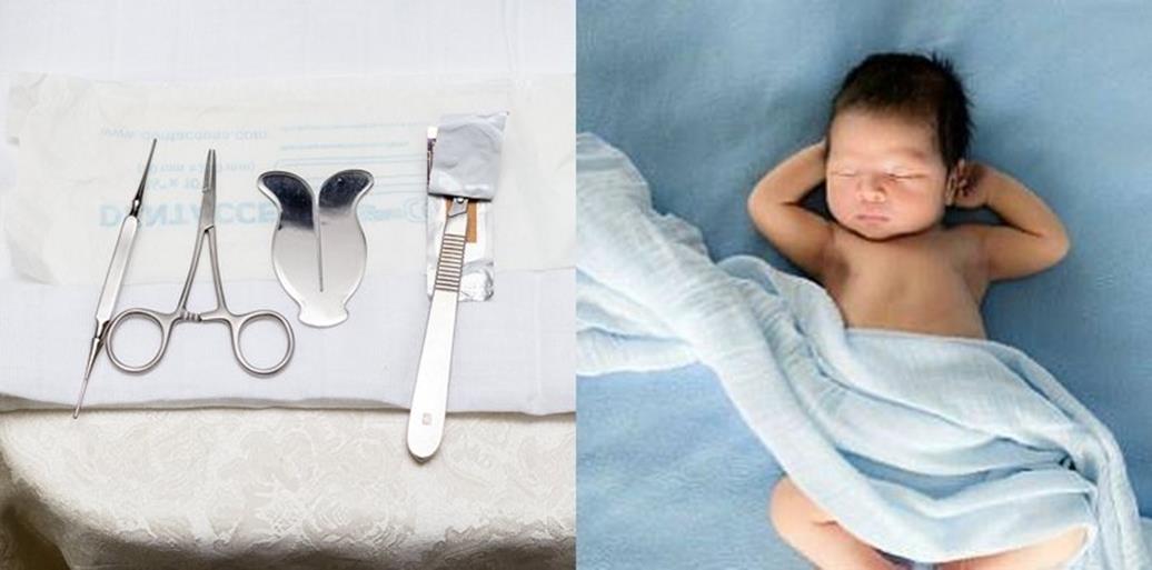 Khitan Bayi yang Menginspirasi: Cerita Sukses dari Rumah Khitan Tanggulangin || 0815 1521 0008