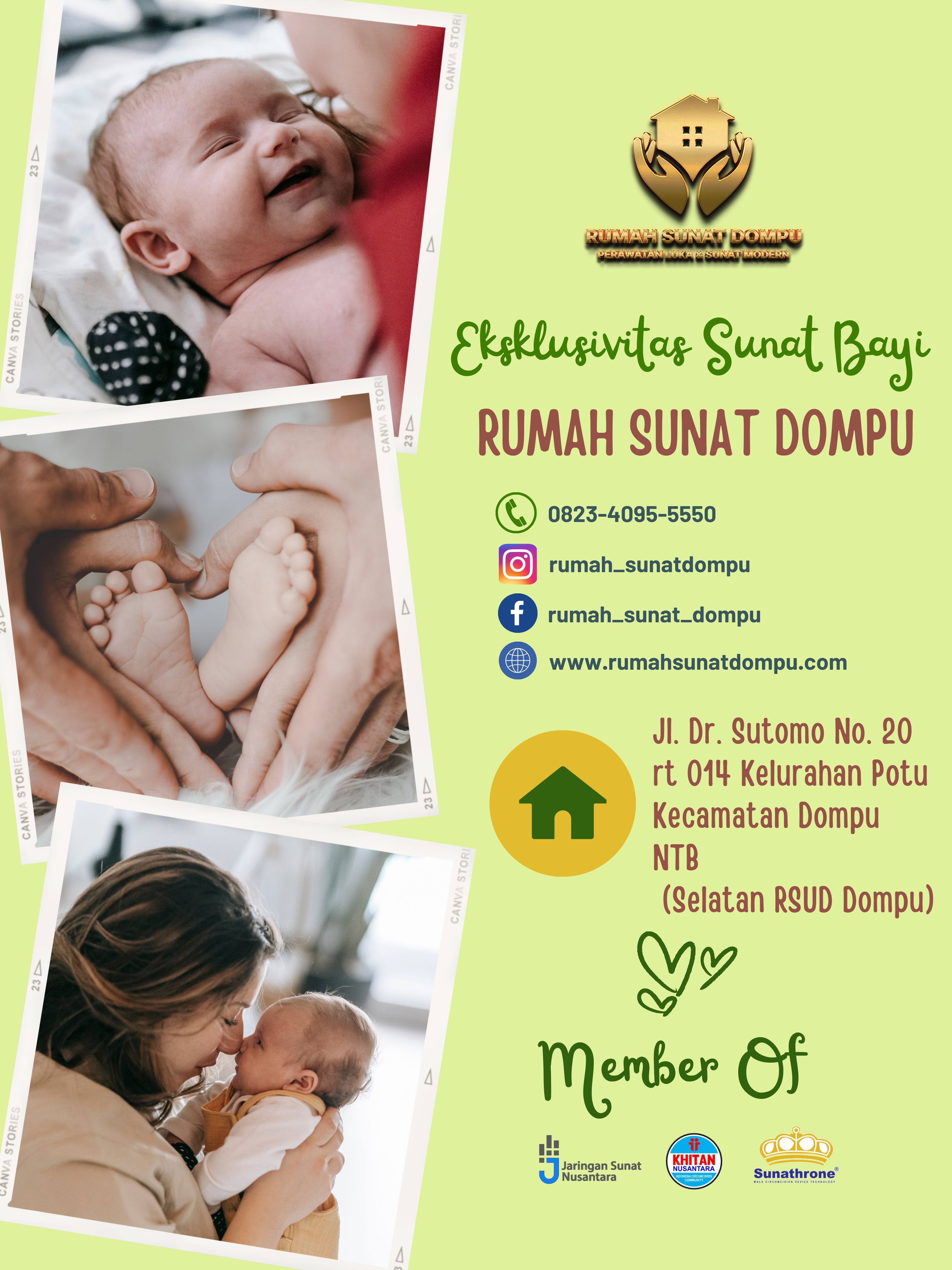 Mengungkap Eksklusivitas Sunat Bayi, Keindahan dan Makna Mendalam di RUMAH SUNAT DOMPU