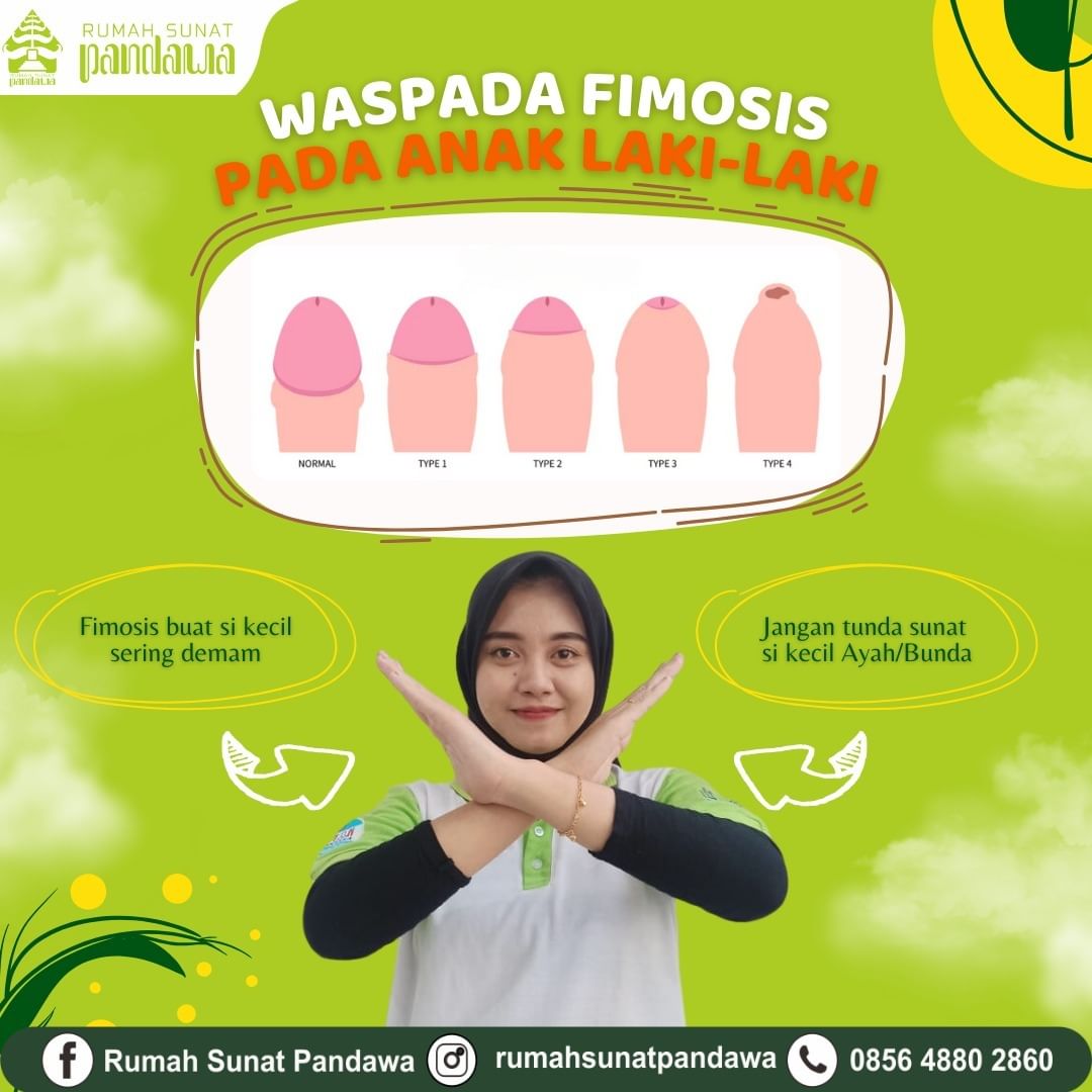 Ayah Bunda Mencari Tempat Sunat untuk Bayi Fimosis di Kediri dan Sekitarnya? Rumah Sunat Pandawa adalah Jawaban dari Pencarian Ayah Bunda, Tempat Sunat Nomor Satu di Kota Kediri