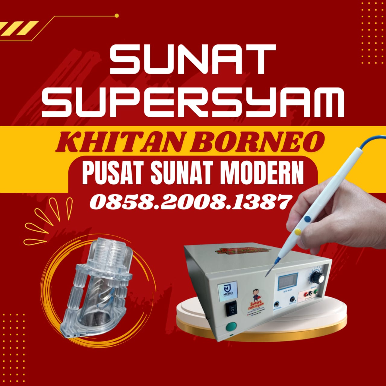 Keindahan Sunat yang Tak Terbantahkan:  Sunat Supersyam di Pangkalan Bun - Sukamara