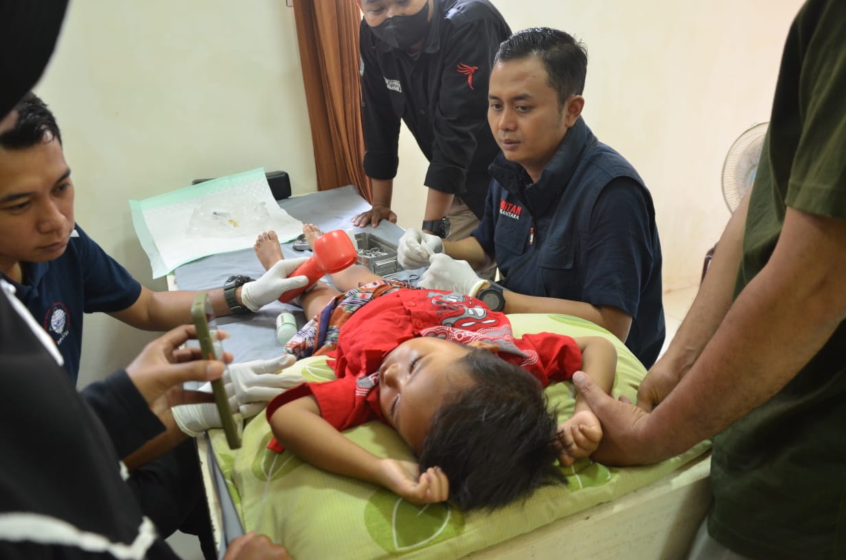 Layanan Sunat Laser Metode Sunat Cepat Sembuh Di Situbondo