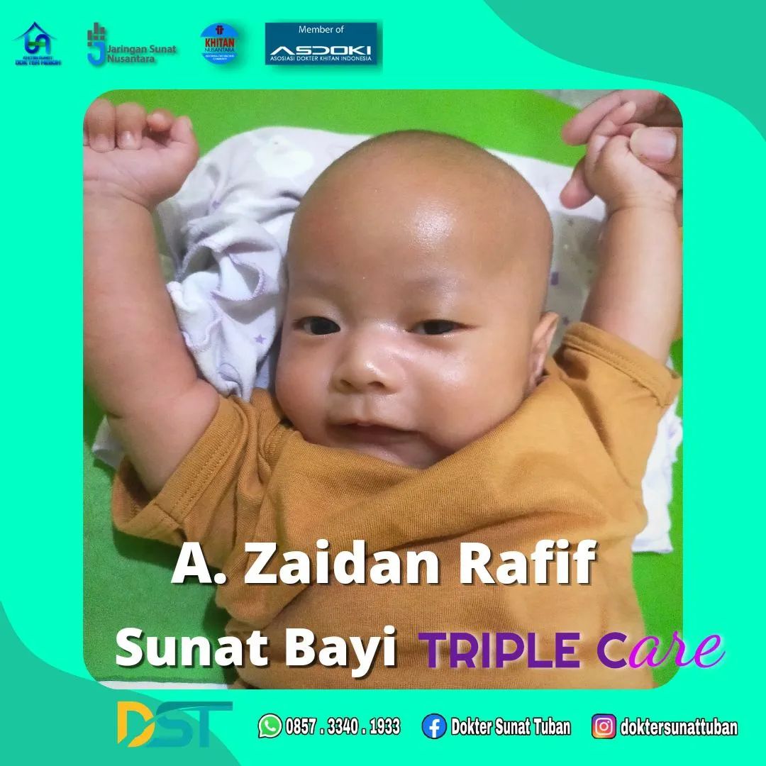 Percayakan Sunat Bayi Anda Hanya di Praktek Dokter Sunat Tuban dengan Keamanan dan Kenyamanan Terbaik