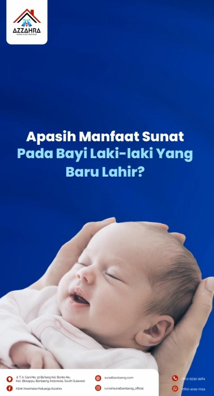 Kelebihan Sunat Tanpa Jahitan Bagi Bayi di Bantaeng