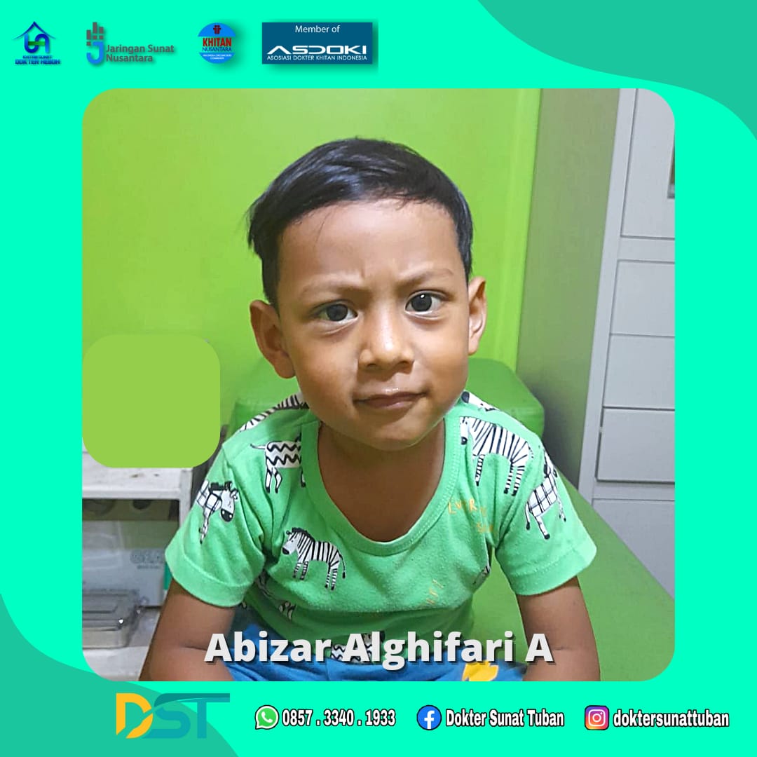 Layanan Sunat Anak Fimosis yang Tepercaya dan Terjamin di Praktek Dokter Sunat Tuban