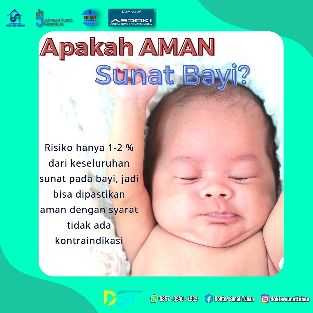 Sunat Bayi yang Aman dan Terpercaya di Klinik Praktek Dokter Sunat Tuban