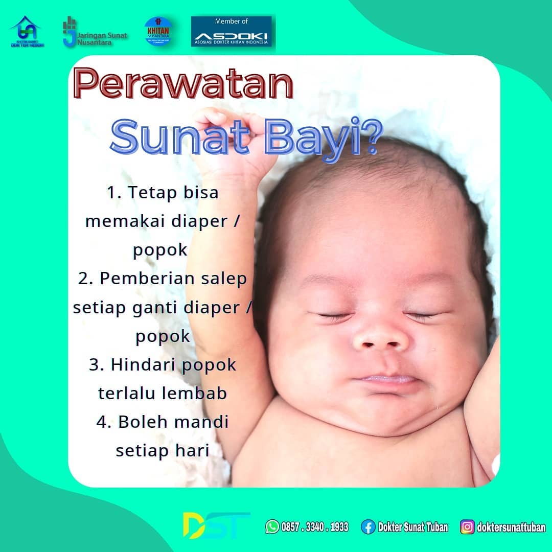 Sunat Bayi yang Aman dan Terpercaya di Klinik Praktek Dokter Sunat Tuban