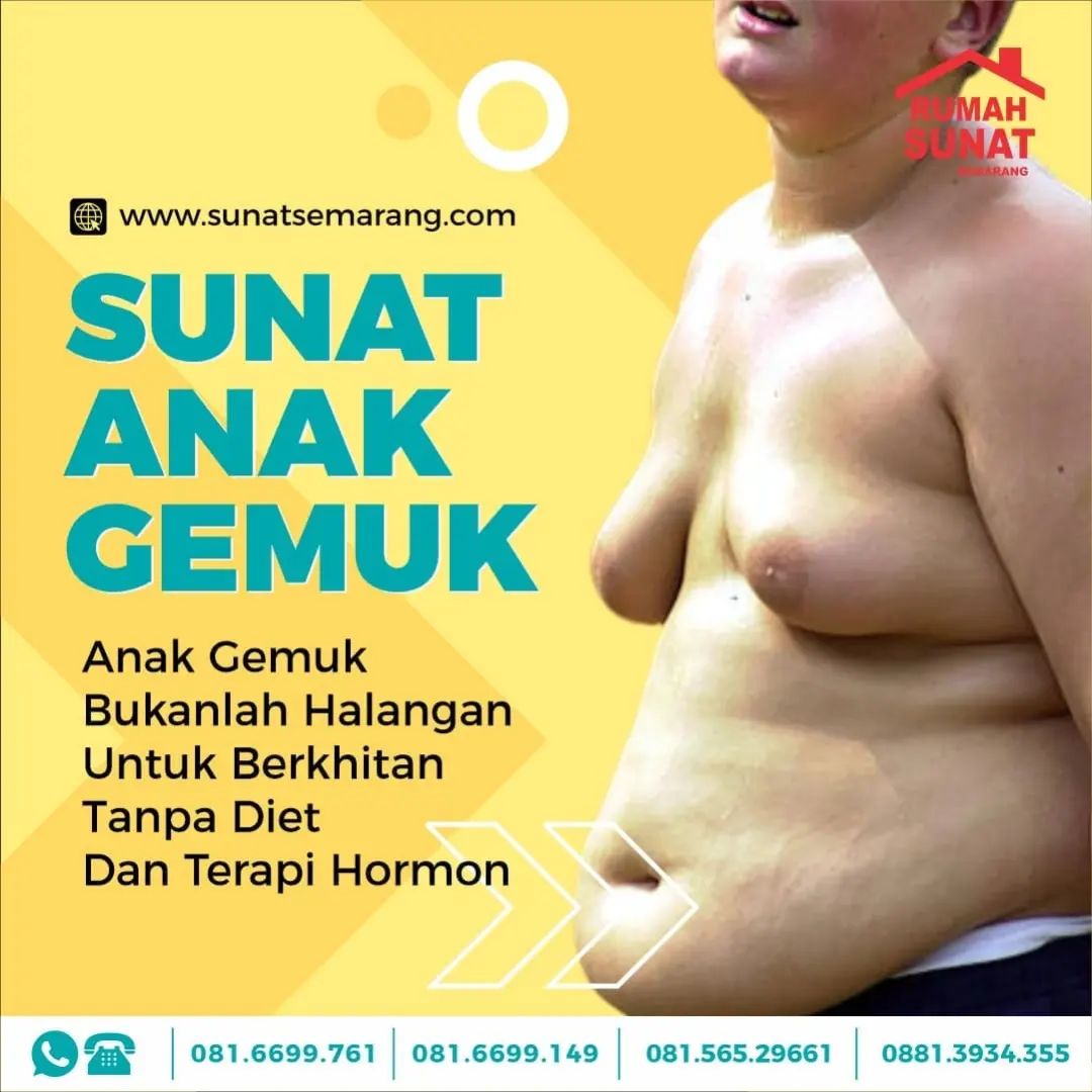 Sunat Anak Gemuk di Semarang: Tipe Gemuk dan Metode Terbaik untuk Anak Anda