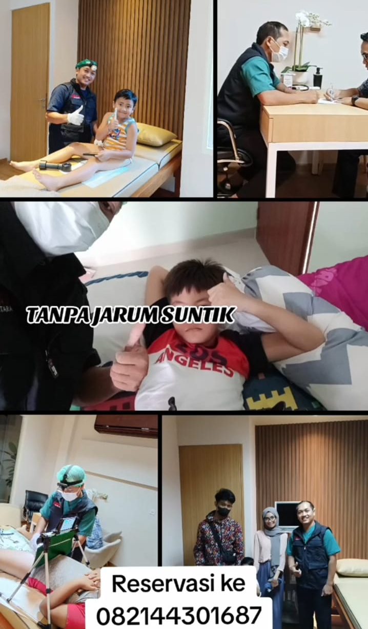 Sunat Tanpa Suntik: Kenali Inovasi Terkini untuk Sunat Ramah Anak di Bali