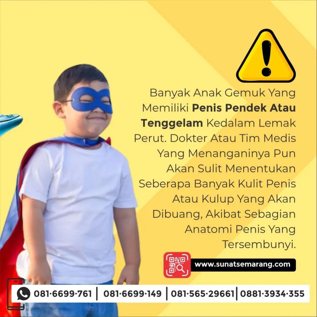 Ingin Menyunat Anak Gemuk Tanpa Khawatir? Rumah Sunat Semarang Sediakan Layanan Sunat Exclusive