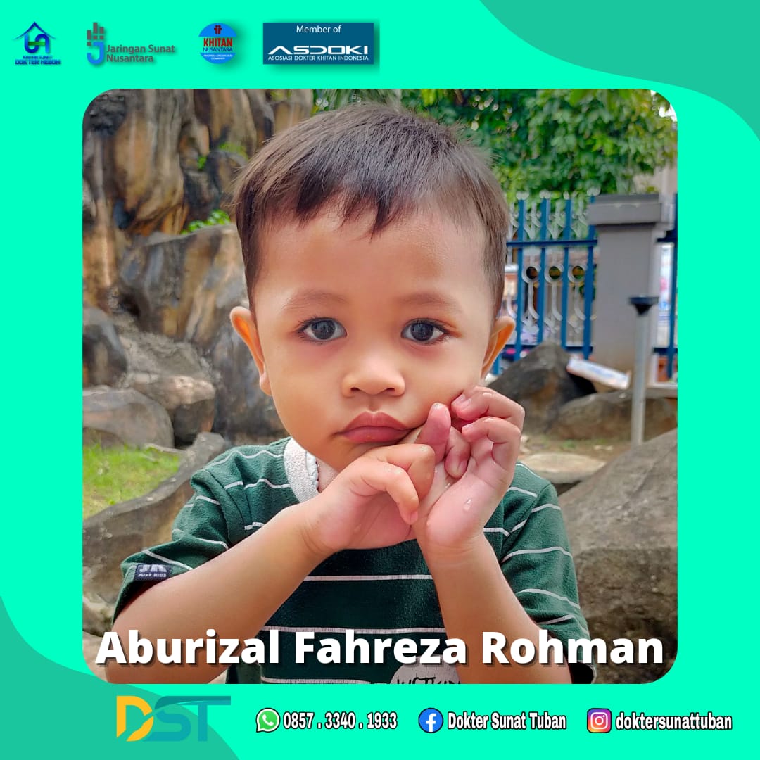 Solusi Sunat Modern di Tuban: Nikmati Perawatan yang Lebih Aman dan Tanpa Rasa Sakit!