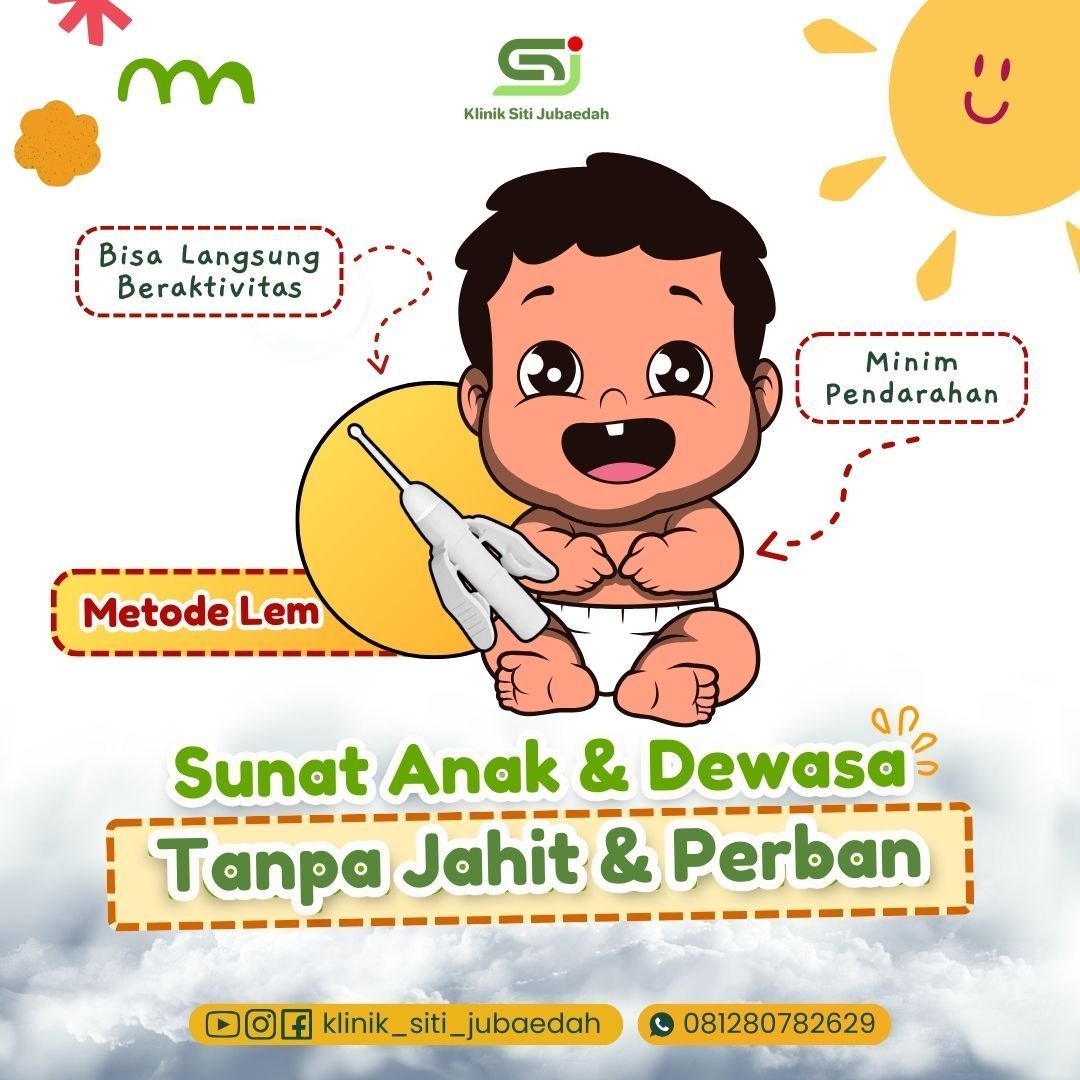 Khitan Bayi Tanpa Rasa Sakit dengan Teknologi Mutakhir di Klinik Siti Jubaedah Tangerang