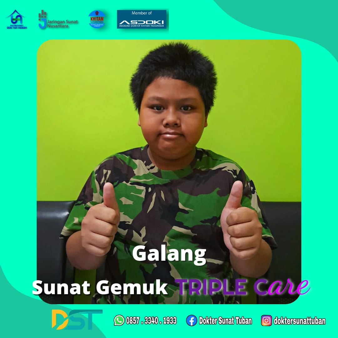 Sunat Anak Gendut di Tuban: Solusi Terbaik Bagi Kesehatan Anak Anda
