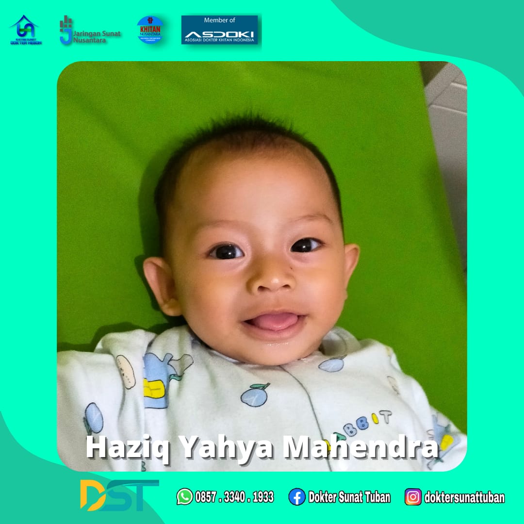 Sunat Bayi Praktis dengan Metode Modern di Tuban