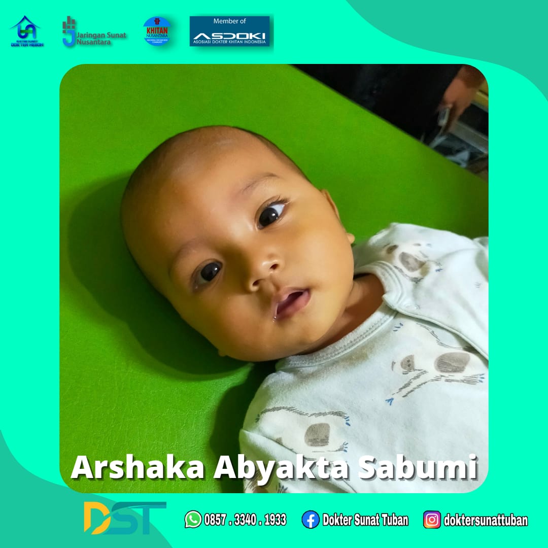 Sunat Bayi dengan Cara Terbaik? Datang ke Klinik Praktek Dokter Sunat Tuban