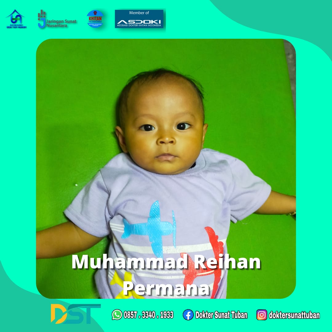 Dokter Sunat Bayi Terbaik di Tuban untuk Menjamin Kesehatan Bayi Anda