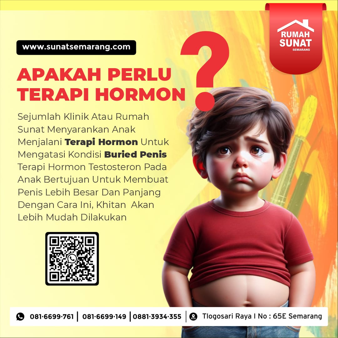 Layanan Sunat Anak Gemuk di Semarang, Tidak Perlu Menjalani Terapi Hormon