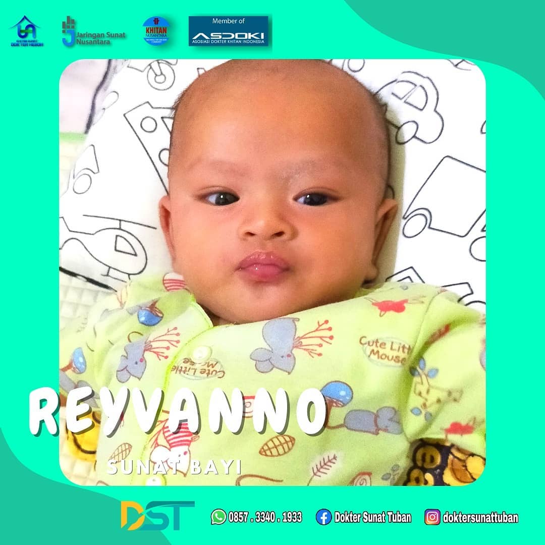 Tempat Sunat Bayi dengan Fimosis di Klinik Praktek Dokter Sunat Tuban - Sunat Tenang, Aman, Nyaman, & Minim Rasa Sakit!