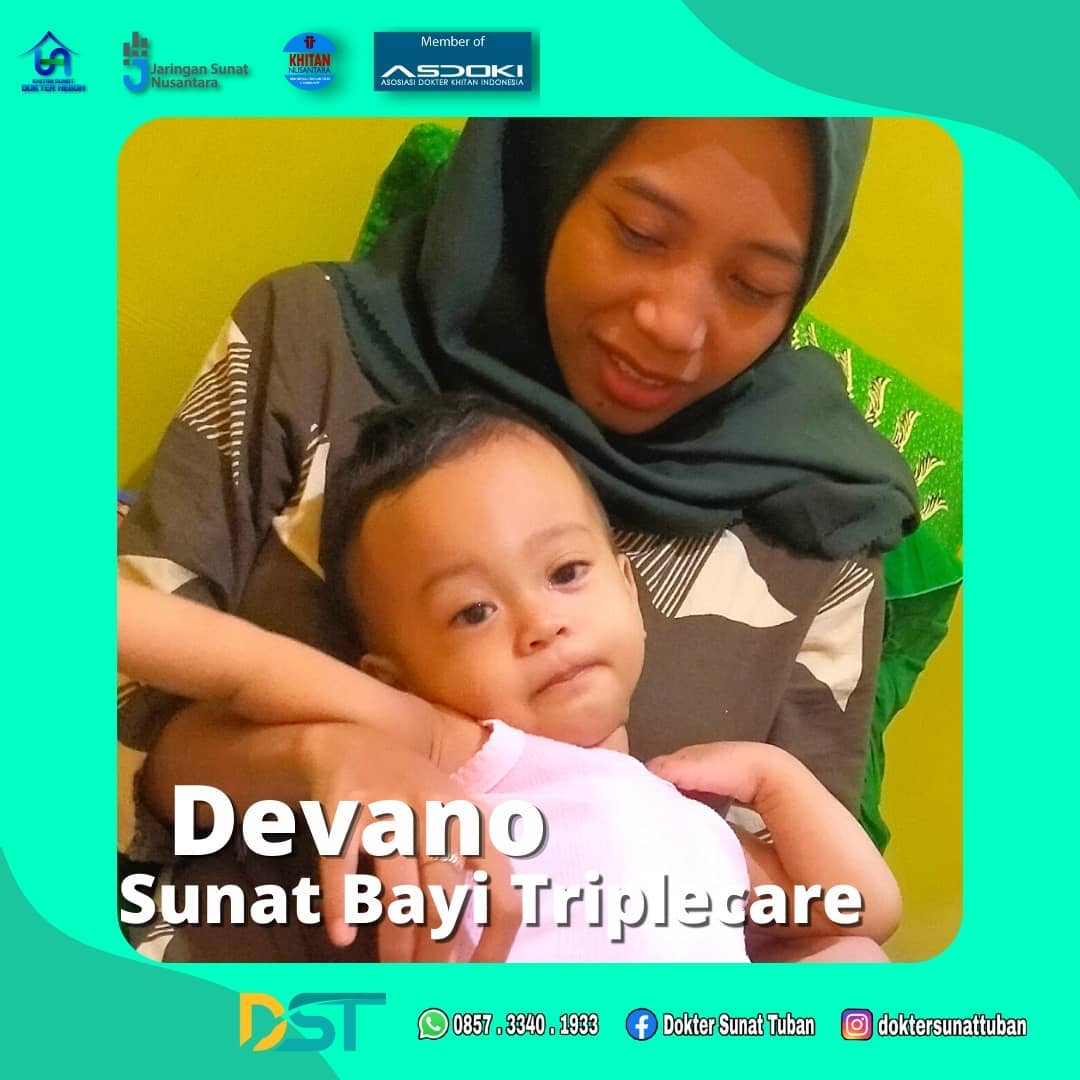 Sunat saat bayi di Tuban, Ditangani Oleh Dokter Profesional dan Terpercaya