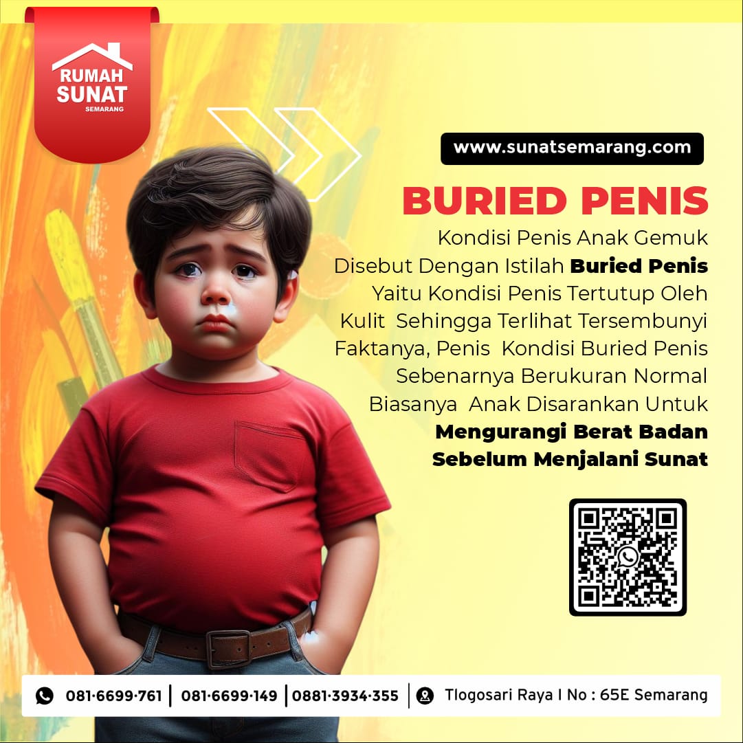 Langkah Sehat Tanpa Diet: Sunat Anak Gemuk di Semarang dengan Rumah Sunat Semarang