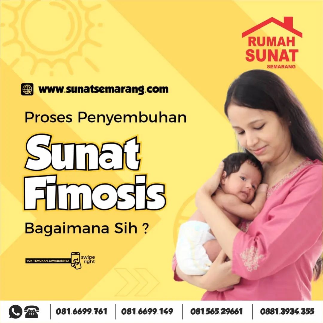 Fimosis pada Anak? Sunat anak dengan fimosis di Semarang - Gejala, Penyebab, & Cara Mengatasinya!