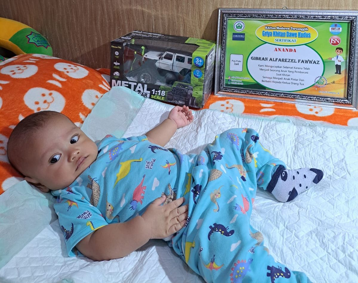 Panduan Lengkap Sunat Bayi di Kudus: Solusi Terbaik dari Dokter Profesional Klinik Griya Khitan Dawe Kudus