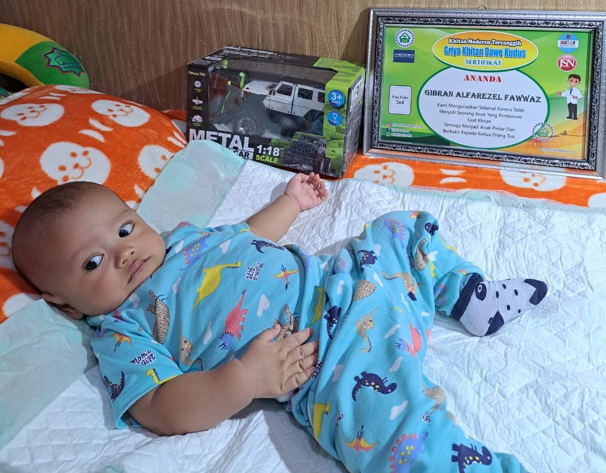 Mengapa Sunat Bayi di Klinik Griya Khitan Dawe Kudus adalah Pilihan Terbaik?