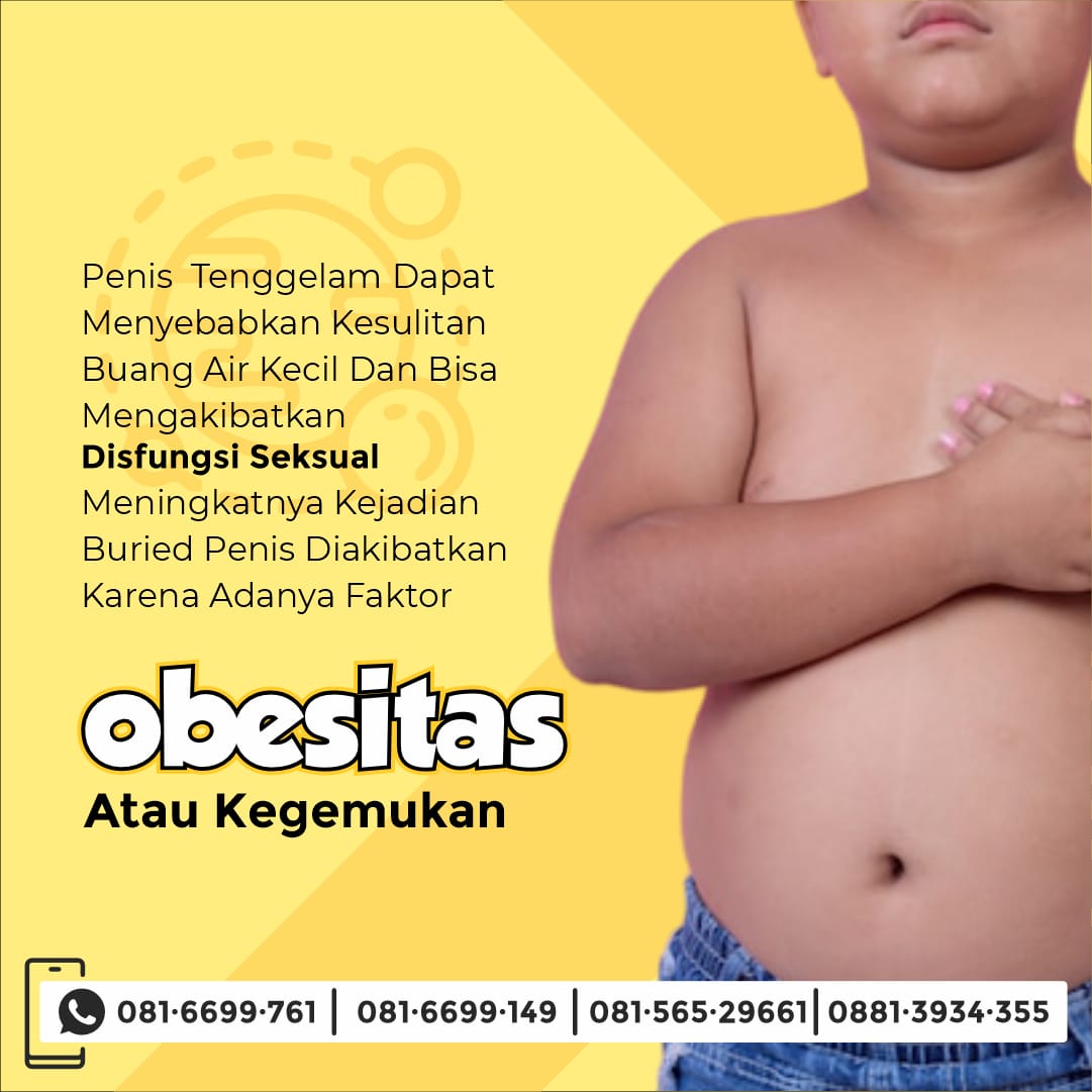 Sunat Gemuk Sabar Semarang : Sunat Anak Dengan Berat Badan Lebih di Rumah Sunat Semarang - 081 6699 761