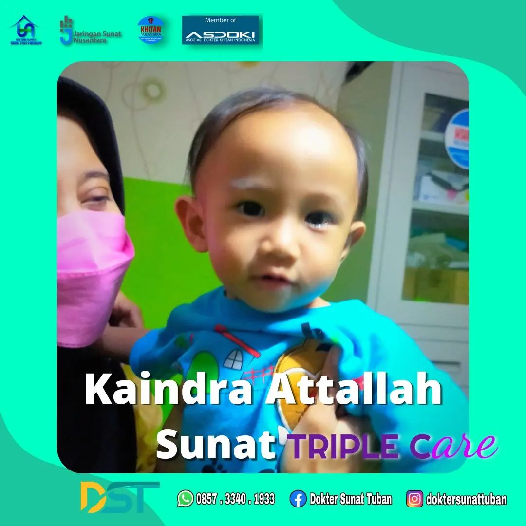 Pentingnya Sunat Anak untuk Mengatasi Fimosis: Layanan Profesional di Klinik Praktek Dokter Sunat Tuban