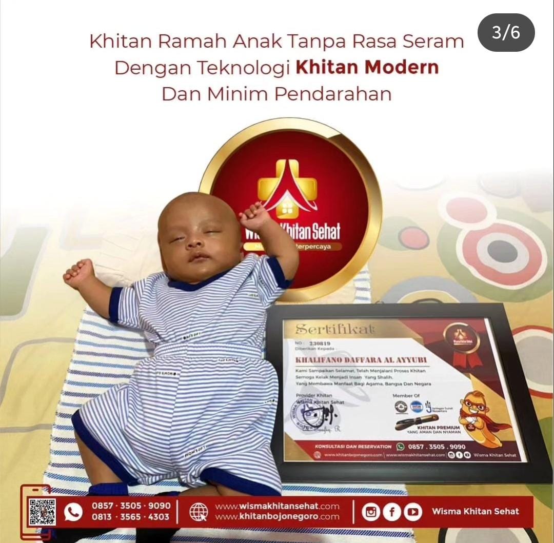 Kelebihan Khitan Saat Bayi di Wisma Khitan Sehat Adalah Minim Pendarahan - 0857 3505 9090