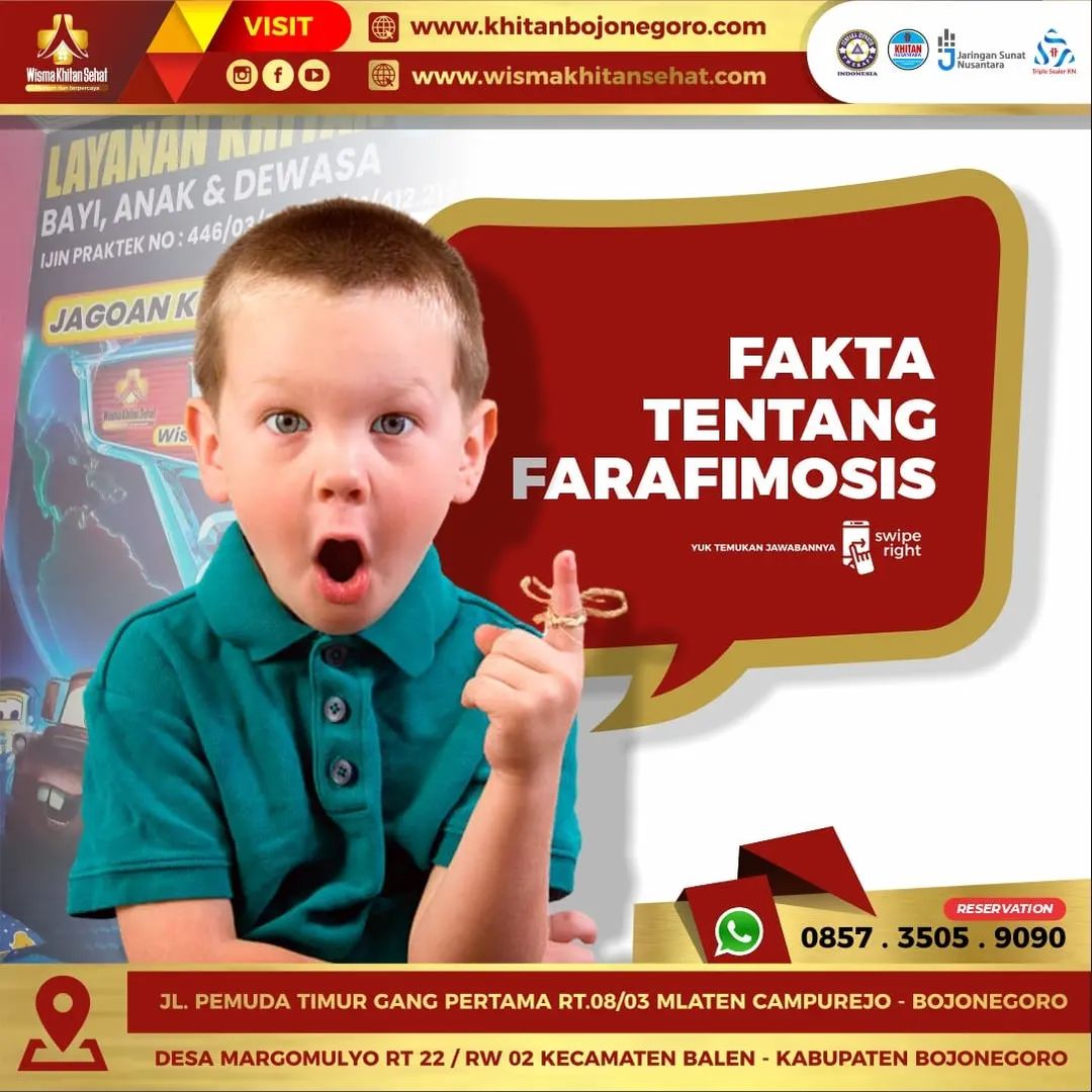 Fakta Parafimosis Fakta Parafimosis dan Penanaganannya di Wisma Khitan Sehat Bojonegoro - 0857 3505 9090